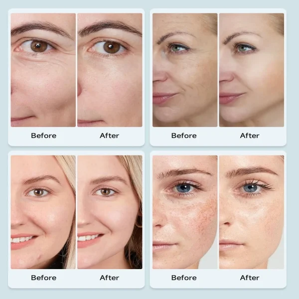 Face Mask Before and After used
